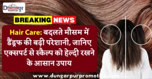 Hair Care: बदलते मौसम में डैंड्रफ की बढ़ी परेशानी, जानिए एक्सपर्ट से स्कैल्प को हेल्दी रखने के आसान उपाय