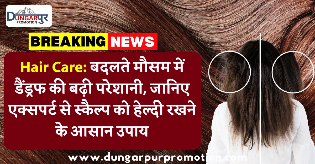Hair Care: बदलते मौसम में डैंड्रफ की बढ़ी परेशानी, जानिए एक्सपर्ट से स्कैल्प को हेल्दी रखने के आसान उपाय